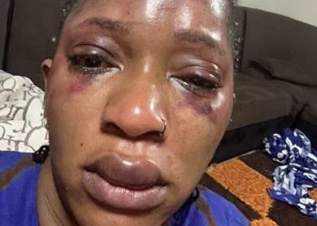 Conakry : l’Ambassade de France réagit à la « violence » subie par Djelikaba Bintou